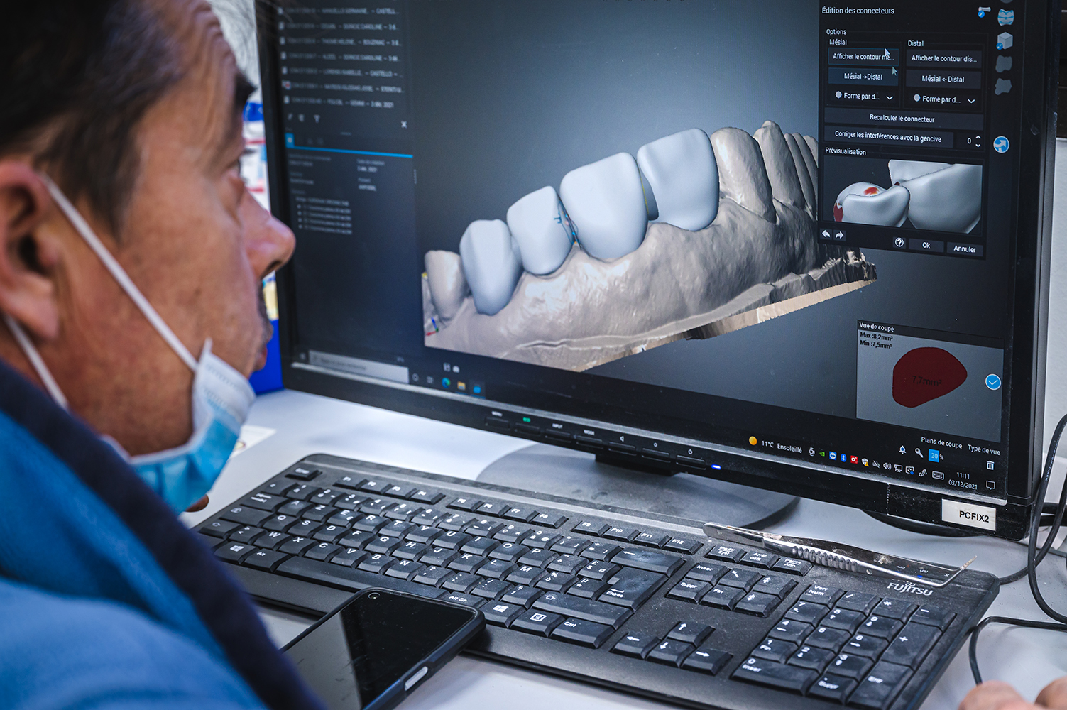 Dental Concept HD 77